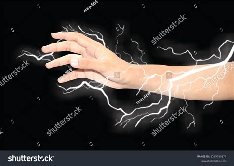Electricity Shock 的图像结果