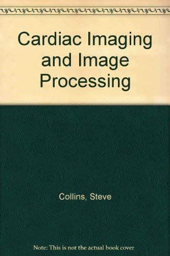 Buy Cardiac Imaging and Image Processing Book Online at Low Prices in ...