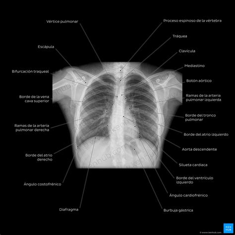Epitelio Cilíndrico Pseudoestratificado: Características y funciones.