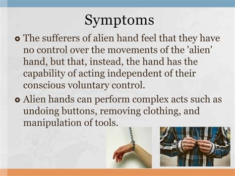 Image result for Alien Hand Syndrome Real