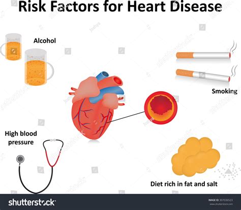 Risk Factors Heart Disease Labeled Diagram 스톡 일러스트 307036523 | Shutterstock