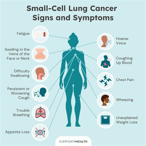 Small Cell Lung Cancer (SCLC): Symptoms, Causes, Diagnosis, Treatment, and Prevention