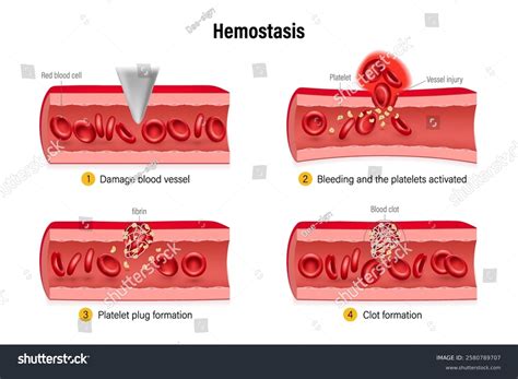 Hemostasis Wound Healing Process Stages Process Stock Vector (Royalty Free) 2580789707 ...