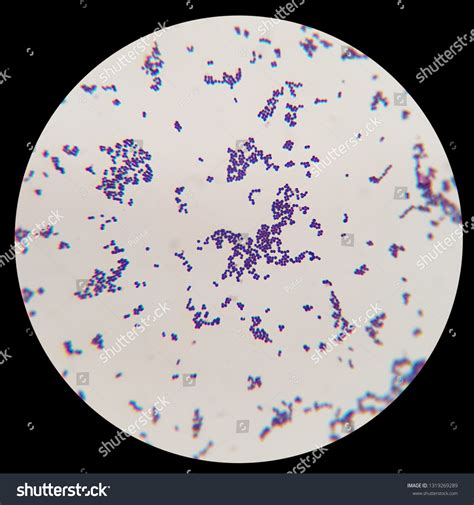 Streptococcus Bacteria Gram Stain Streptococcus Pneumonia Fungus