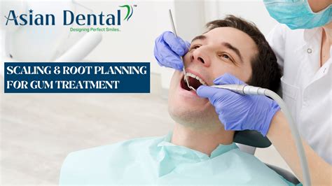 Scaling and Root Planning: What to Expect During Gum Treatment
