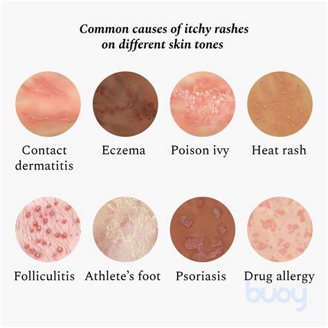 Itchy Skin Causes
