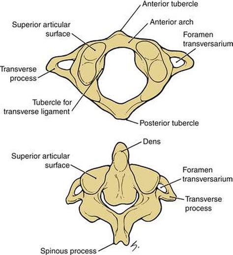 Pictures Of Atlas Axis Joint
