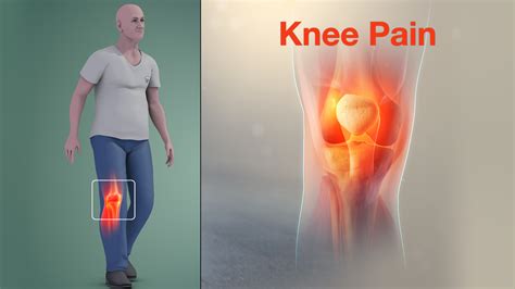 What Causes Below The Knee Swelling