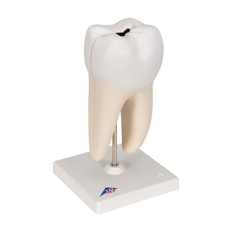 Anatomical Teaching Models - Plastic Human Dental Models - Lower Molar ...