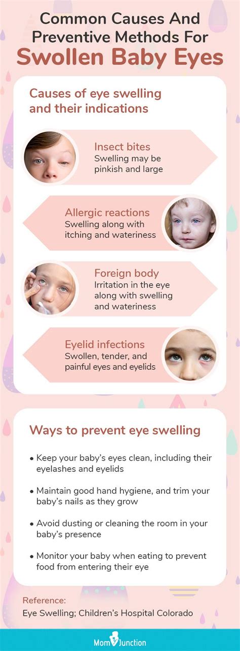 Eye Swelling In Toddlers at Pauline Dane blog