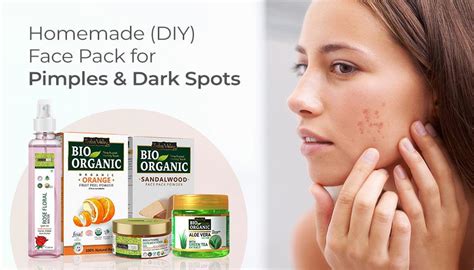 Homemade(DIY) Face Pack for Pimples and Dark Spots – Indus Valley