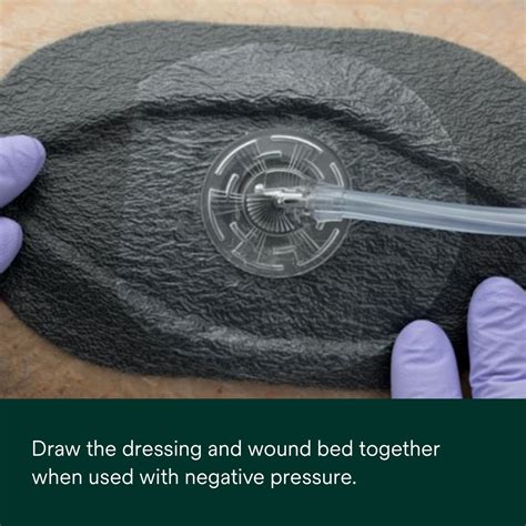 3M™ V.A.C.® Peel and Place Dressing Kit