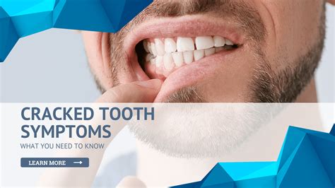Cracked Tooth Symptoms: What You Need to Know - Eastern Idaho Endodontics