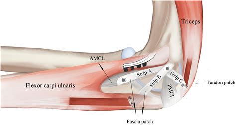 Elbow Anatomy Ligaments And Tendons
