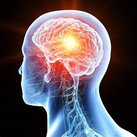 एराक्नॉयड सिस्ट: कारण, लक्षण और इलाज | Arachnoid Cysts in Hindi