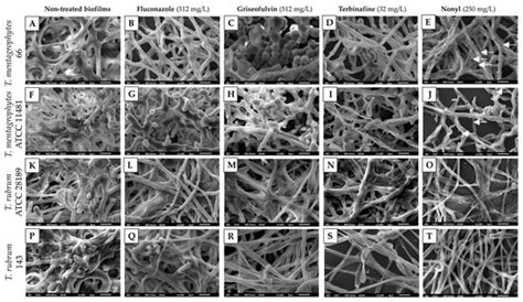 Membranolytic Activity Profile of Nonyl 3,4-Dihydroxybenzoate: A New ...