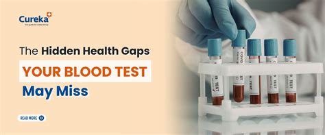 Hidden Health Gaps Your Blood Tests May Miss