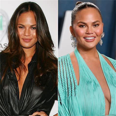 Chrissy Teigen Before and After: Did the Model Get Plastic Surgery?