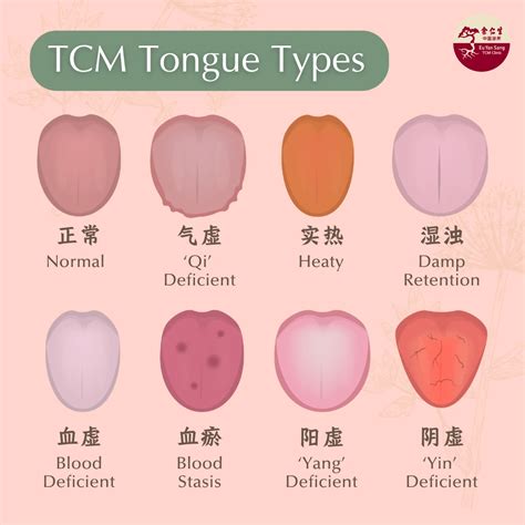 A TCM Physician’s Guide to Understanding Your Tongue - Eu Yan Sang TCM Clinic