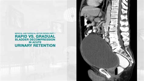 AIS Channel · Medical And Surgical Myths Series part 1: Rapid versus ...