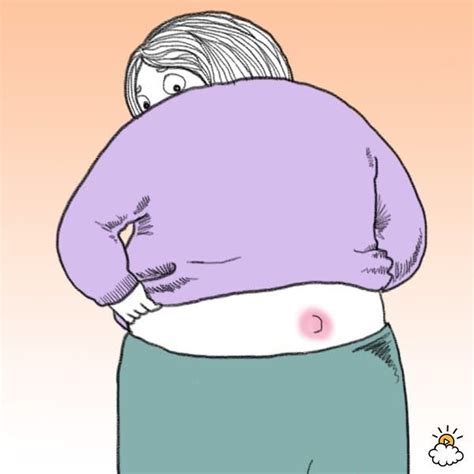 Image result for Exploding Pimple On Bottom