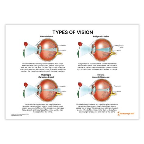 Types of Vision 的图像结果
