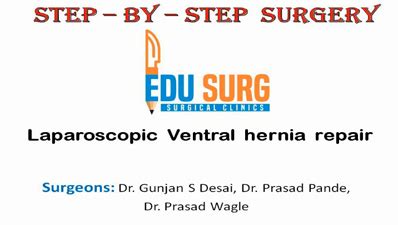 Videos - Step By Step Surgery | EduSurg