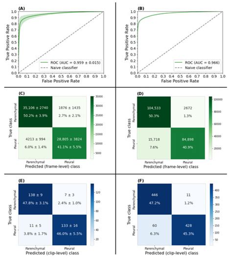 Enhancing Annotation Efficiency with Machine Learning: Automated ...