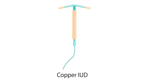 Copper Iud Facts at Lachlan Legge blog