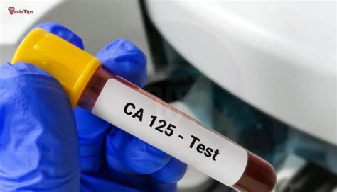 CA 125 Test Price, Purpose, Sample Report & Results [2024]