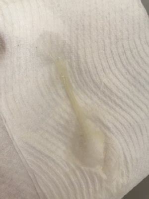 mucus plug vs discharge - prenatal vitamins