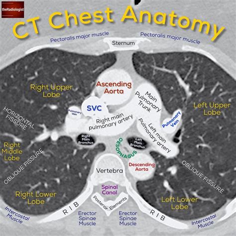 Labeled Chest Ct Scan Anatomy