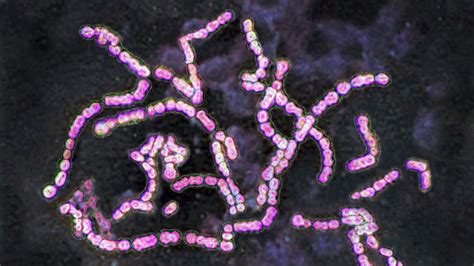 Unseen Threat: The Surge of Strep Infections Across the U.S.