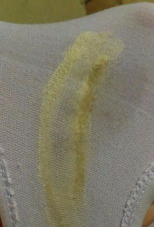 Ideas 60 of Light Yellow Discharge No Smell | klassenlehrestunde