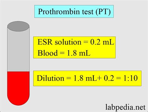 Image result for Prothrombin Time Normal Result