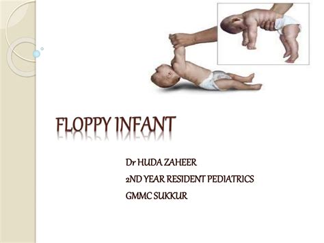 floppy infant.pptx