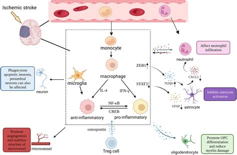 Ischemic Stroke Pathophysiology