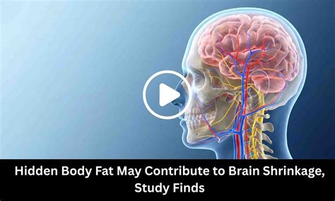 Hidden Body Fat May Contribute to Brain Shrinkage, Study Finds