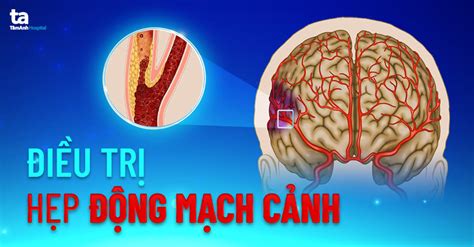 AMBIL SEKARANG