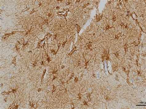 ZEISS Axio Imager 2 for Life Science Research