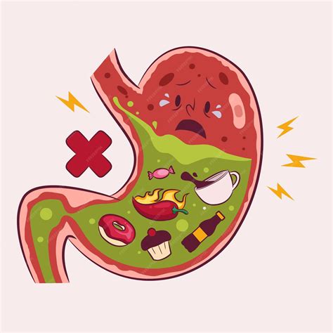 Ilustración Estómago inflamado e irritado por partículas de comida chatarra | Vector Premium