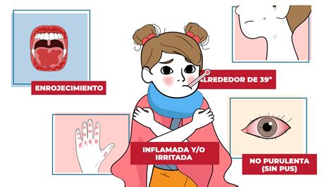 La enfermedad de Kawasaki representa la principal causa de cardiopatía adquirida infantil en ...