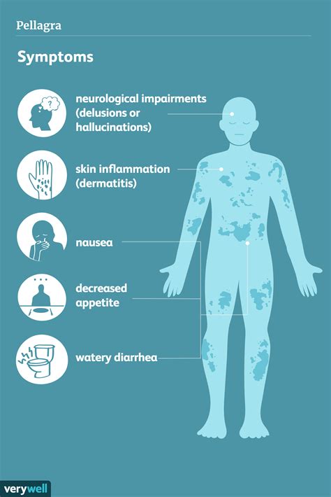 What Prevents Pellagra