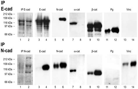 Constitutive Occurrence of E:N-cadherin Heterodimers in Adherens ...
