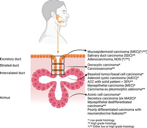 Salivary Gland Cancer Head And Neck: Salivary Gland Tumors: An