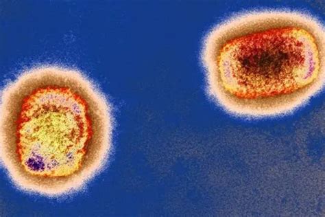 猴痘病毒跟天花的根本区别是什么 猴痘病毒会全球传播吗