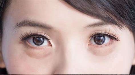 眼周肌肤怎么护理比较好 眼周肌肤的呵护保养常用方法 - 复禾健康
