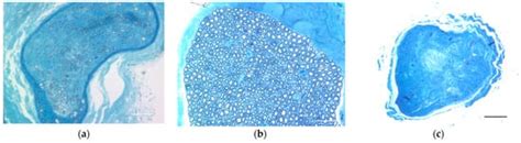 A Therapeutic Strategy for Lower Motor Neuron Disease and Injury ...