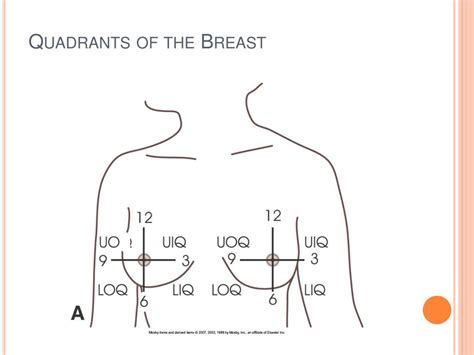 PPT - Mammography PowerPoint Presentation, free download - ID:788060