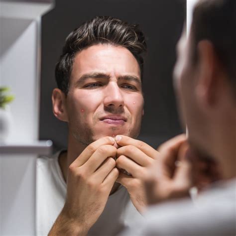 Can Anxiety Cause Pimples? The Connection Between Stress and Breakouts ...